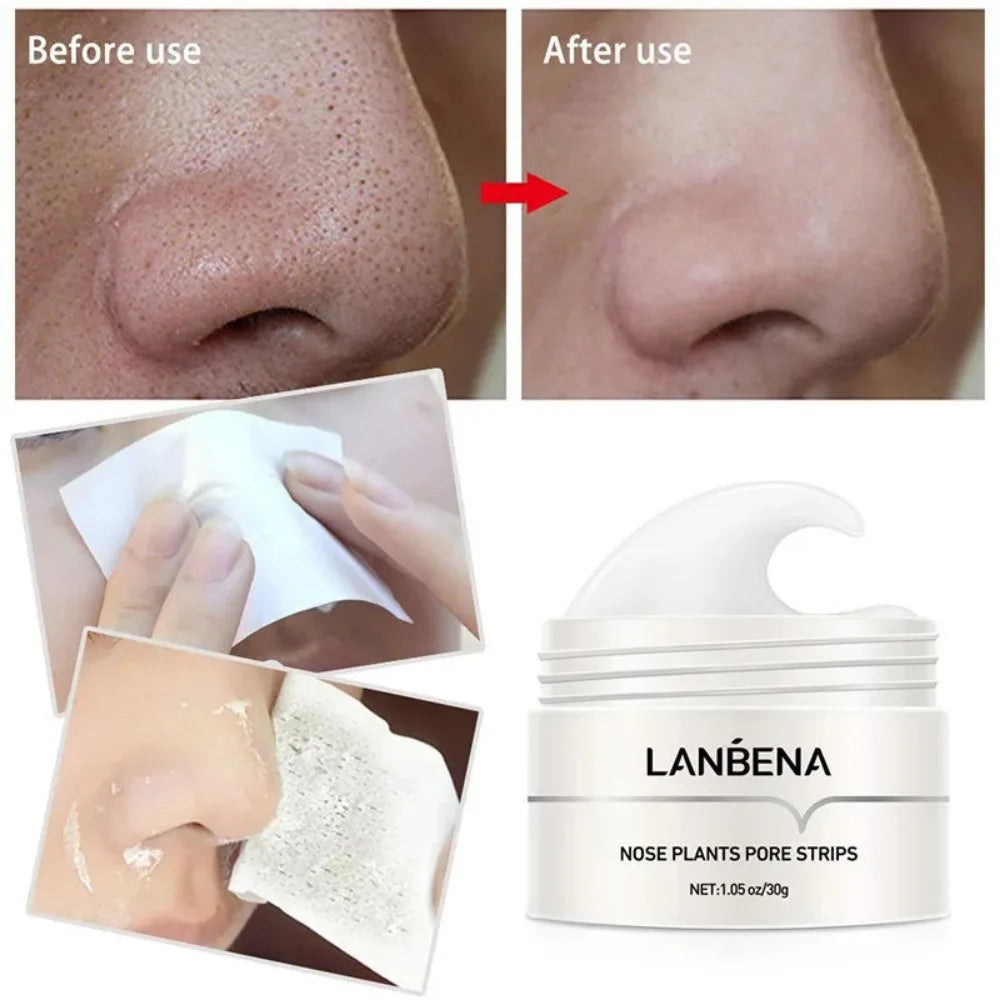 Deep Cleansing Peel-Off Blackhead Mask – Pore-Cleansing Treatment
