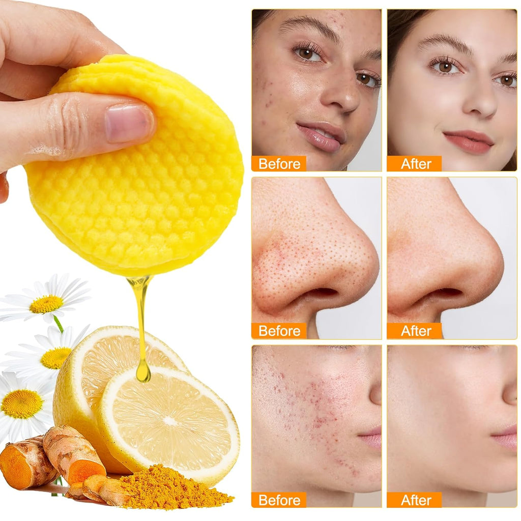Revitalize Your Skin: Turmeric & Kojic Acid Exfoliating Pads with Vitamin C - 50 Count for Oil Control, Hydration & Dullness Reduction