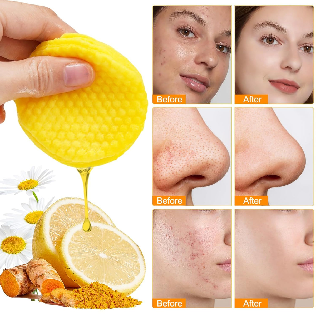 Revitalize Your Skin: Turmeric & Kojic Acid Exfoliating Pads with Vitamin C - 50 Count for Oil Control, Hydration & Dullness Reduction