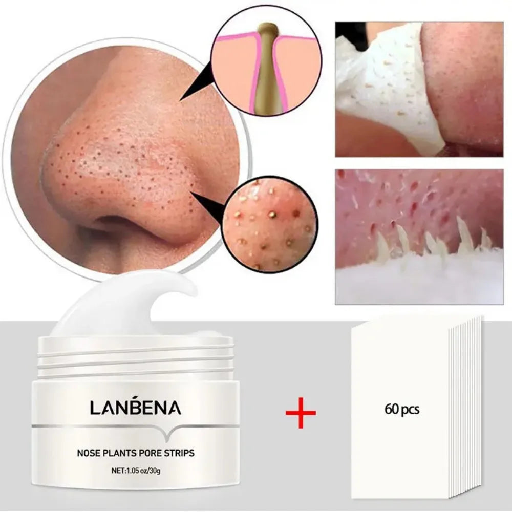 Deep Cleansing Peel-Off Blackhead Mask – Pore-Cleansing Treatment