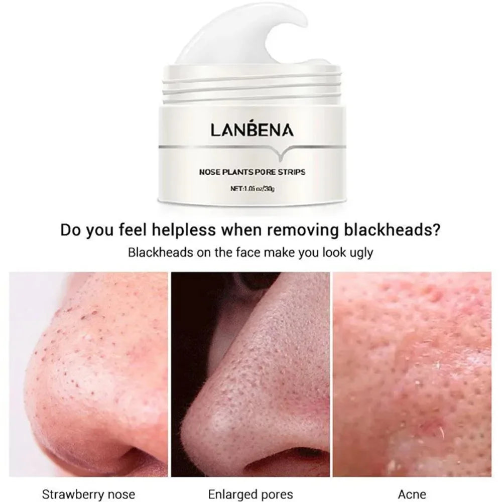 Deep Cleansing Peel-Off Blackhead Mask – Pore-Cleansing Treatment